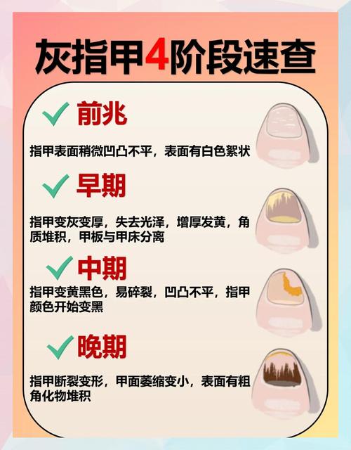 指甲生长速度与代谢季节关联（指甲生长速度与年龄有关吗）