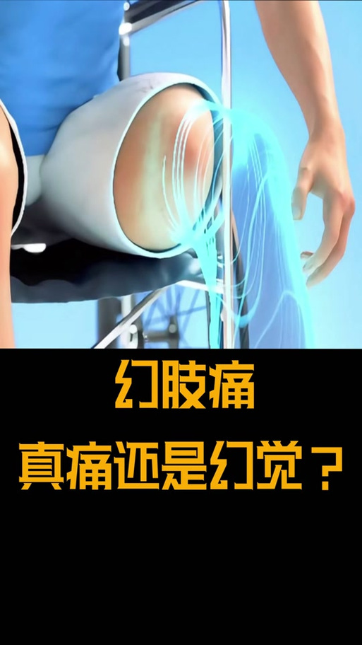 幻肢痛的脑区重塑干预(幻肢痛觉)