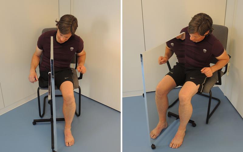 幻肢痛的脑区重塑干预(幻肢痛觉)